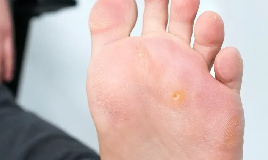 Patiente dans une salle d'attente